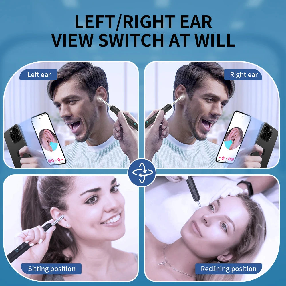 Limpiador de Oídos con Cámara HD WiFi